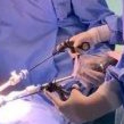videocirurgia_doutores